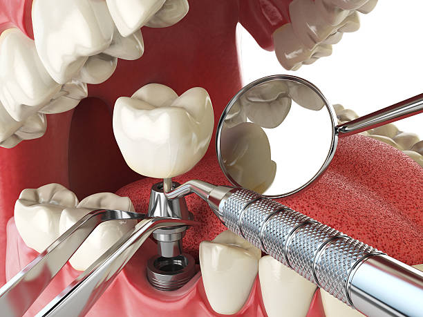 Best Emergency Dental Services for Seniors in Lake Lotawana, MO